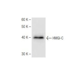 HMGI-C Antibody (2421C6a) - Western Blotting - Image 67285Each CRISPR/Cas9 Knockout (KO) Plasmid product consists of a pool of 3 plasmids designed to ensure identification and cleavage of a specific gene for maximum knockout efficiency. Each plasmid encodes a unique 20 nt sequence derived from the GeCKO (v2) library.