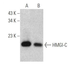 HMGI-C Antibody (2421C6a) - Western Blotting - Image 366641Each CRISPR/Cas9 Knockout (KO) Plasmid product consists of a pool of 3 plasmids designed to ensure identification and cleavage of a specific gene for maximum knockout efficiency. Each plasmid encodes a unique 20 nt sequence derived from the GeCKO (v2) library.