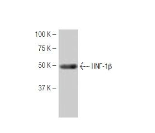 HNF-1β Antibody (94.8) - Western Blotting - Image 53904The Double Nickase Plasmid features a U6 promoter for sgRNA expression, a 20 nt targeting sequence, and a gRNA scaffold to guide Cas9n. It includes a CBh promoter for Cas9n (D10A) and puromycin resistance, GFP for transfection verification, and nuclear localization signals (NLS). The 2A peptide allows co-expression of Cas9n and Puro from a single promoter, enabling precise genome editing with reduced off-target effects.