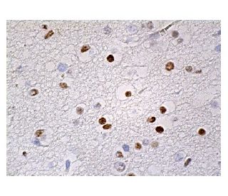 hnRNP A1 Antibody (C-2) - Immunohistochemistry - Image 159203 