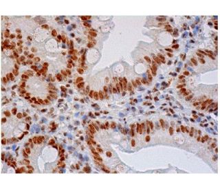 hnRNP F/H Antibody (1G11) - Immunohistochemistry - Image 284776 
