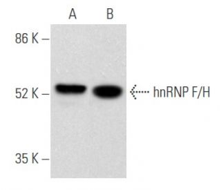 hnRNP F/H Antibody (G-8) - Western Blotting - Image 355528 