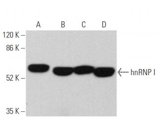 hnRNP I Antibody (SH54) - Western Blotting - Image 359640 