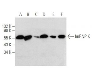 hnRNP K Antibody (F45 P9 C7) - Western Blotting - Image 354691 
