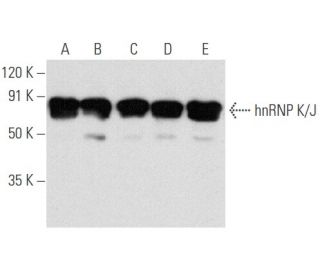 hnRNP K/J Antibody (3C2) - Western Blotting - Image 354688 