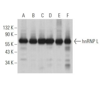 hnRNP L Antibody (4D11) - Western Blotting - Image 364758 