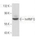 hnRNP Q Antibody (B-8) - Western Blotting - Image 358040