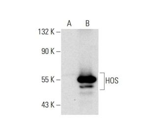 β-TrCP/HOS Antibody (F-10) - Western Blotting - Image 143331