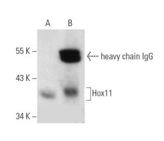 Hox11 Antibody (1D7) - Western Blotting - Image 7163SAM Transcription Activation: SAM system utilizing dCas9-VP64, MS2-P65-HSF1, and sgRNA for precise gene transcription activation.