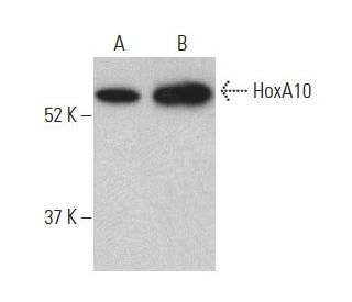 HoxA10 Antibody (E-11) - Western Blotting - Image 398887 