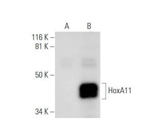 HoxA11 Antibody (B-11) - Western Blotting - Image 295859