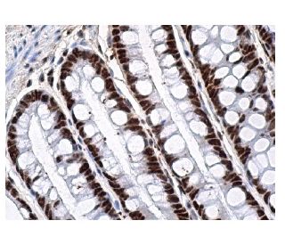 HoxB13 Antibody (F-9) - Immunohistochemistry - Image 156811 