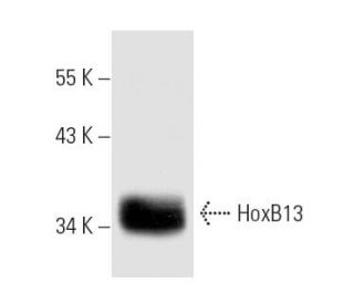 HoxB13 Antibody (F-9) - Western Blotting - Image 352984