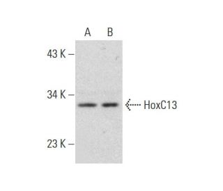HoxC13 Antibody (F-5) - Western Blotting - Image 318579
