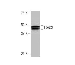 HoxD3 Antibody (4AY) - Western Blotting - Image 53868