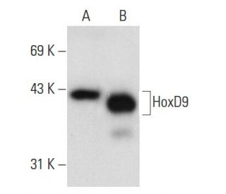 HoxD9 Antibody (E-3) - Western Blotting - Image 55364 