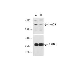 HoxD9 siRNA (h): sc-35585. Western blot analysis of HoxD9 expression in non-transfected control (A) and HoxD9 siRNA transf 