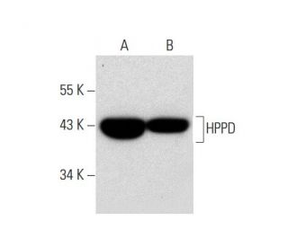 HPPD Antibody (F-5) - Western Blotting - Image 135468 
