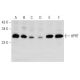 HPRT Antibody (A-3) - Western Blotting - Image 356953 