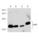 HPRT Antibody (B-11) - Western Blotting - Image 356970