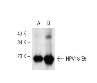 HPV16 E6/18 E6 Antibody (C1P5) - Western Blotting - Image 61230 