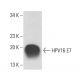 HPV16 E7 Antibody (NM2) - Western Blotting - Image 15598