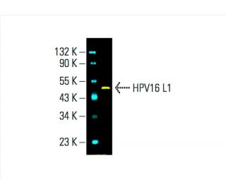 HPV16 L1 Antibody (CAMVIR-1) - Western Blotting - Image 392288