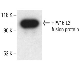 HPV16 L2 Antibody (2JGmab#4) - Western Blotting - Image 411073