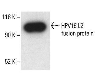 HPV16 L2 Antibody (2JGmab#8) - Western Blotting - Image 411075