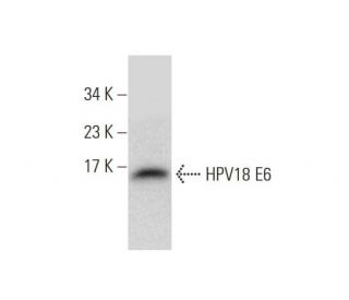 HPV18 E6 Antibody (G-7) - Western Blotting - Image 144610