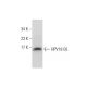 HPV18 E6 Antibody (G-7) - Western Blotting - Image 144610