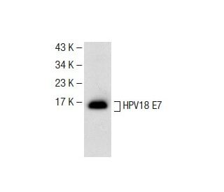 HPV18 E7 Antibody (F-7) - Western Blotting - Image 141520 