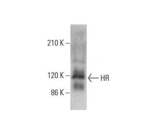 HR Antibody (A-11) - Western Blotting - Image 351836 