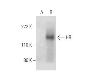 HR Antibody (D-4) - Western Blotting - Image 301522