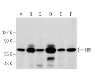 HRI Antibody (D-12) - Western Blotting - Image 356989Each CRISPR/Cas9 Knockout (KO) Plasmid product consists of a pool of 3 plasmids designed to ensure identification and cleavage of a specific gene for maximum knockout efficiency. Each plasmid encodes a unique 20 nt sequence derived from the GeCKO (v2) library.