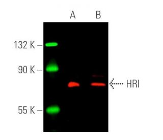HRI Antibody (D-12) - Western Blotting - Image 391025