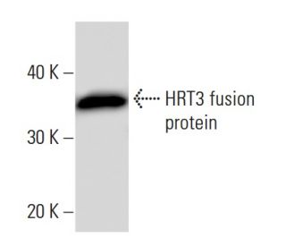 HRT3 Antibody (3555C3a) - Western Blotting - Image 16675
