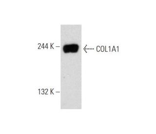 COL1A1 (C-18)-R: sc-8784-R. Western blot analysis of COL1A1 expression in Hs68 whole cell lysate. 