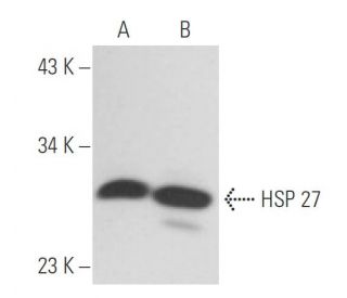 HSP 27 Antibody (HSP25-31) - Western Blotting - Image 15437 