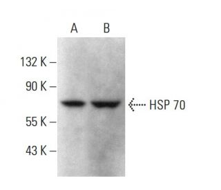 HSP70 Antibody (6D444) - Western Blotting - Image 377692 