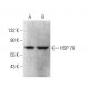 HSP70 Antibody (6D444) - Western Blotting - Image 377692 