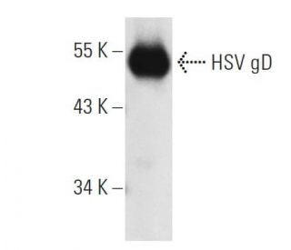HSV-1 gD Antibody (DL6) - Western Blotting - Image 6518