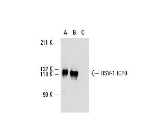 HSV-1 ICP0 Antibody (11060) - Western Blotting - Image 13577