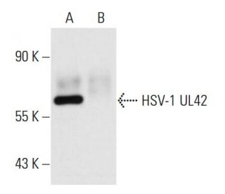 HSV-1 UL42 Antibody (13D11) - Western Blotting - Image 14092