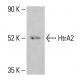 HtrA2 Antibody (E-3) - Western Blotting - Image 414344