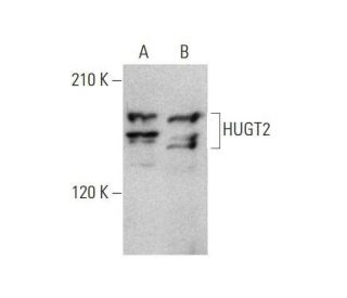 HUGT2 Antibody (G-7) - Western Blotting - Image 351670 