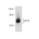 human adipose tissue extract: sc-363750. Western blot analysis of CYP19... 
