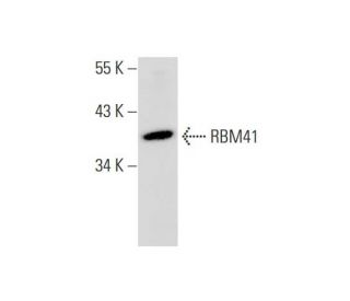 human bladder extract: sc-363751. Western blot analysis of RBM41 expression... 