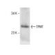 human bone marrow extract: sc-363752. Western blot analysis of TPMT...
