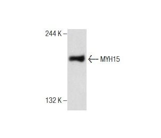 human breast extract: sc-363753. Western blot analysis of MYH15 expression... 